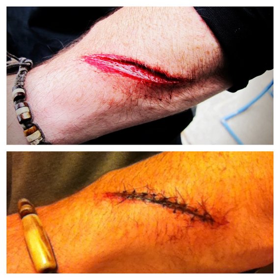 Will's Stitches